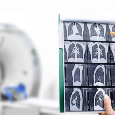 scanner-thoracique-880x440 - Centre De Radiologie Al Baraka